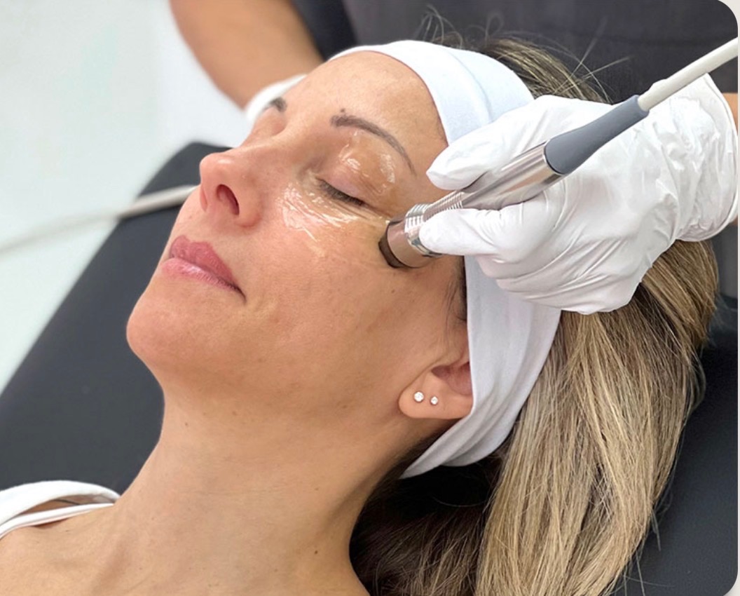 A clinician performs a gentle radiofrequency treatment around a patient’s eye